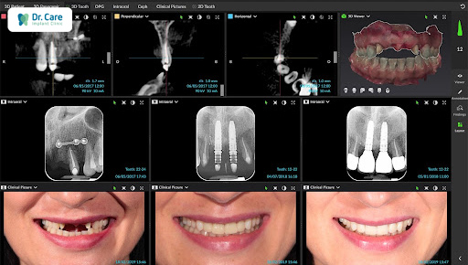 Dr. Care - Implant Clinic chú trọng đầu tư trang thiết bị y khoa chuyên nghiệp