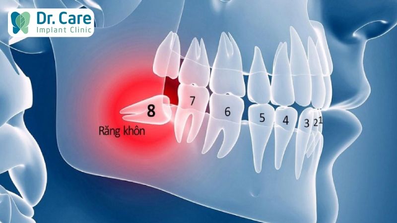 Vị trí và chức năng của răng khôn