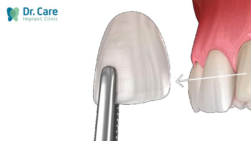 Tháo răng sứ bọc lại có đau không?