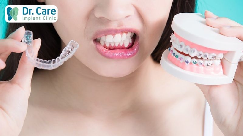 Điều trị khớp cắn chéo do cả răng và xương