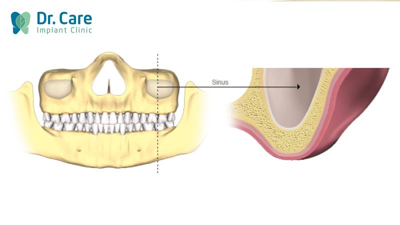 Nâng xoang có đau không? Có biến chứng gì không?