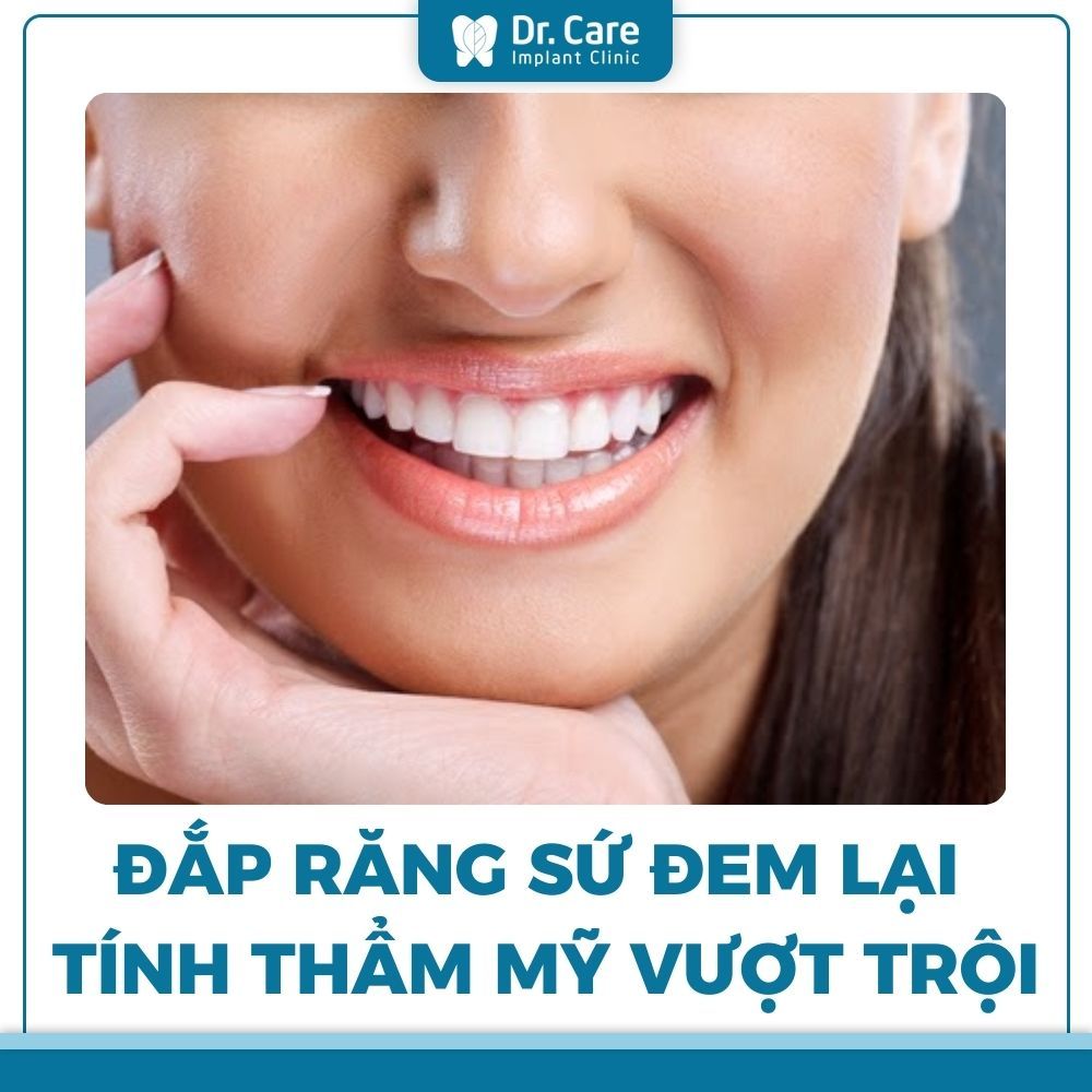 Những ưu điểm nổi bật của đắp răng sứ