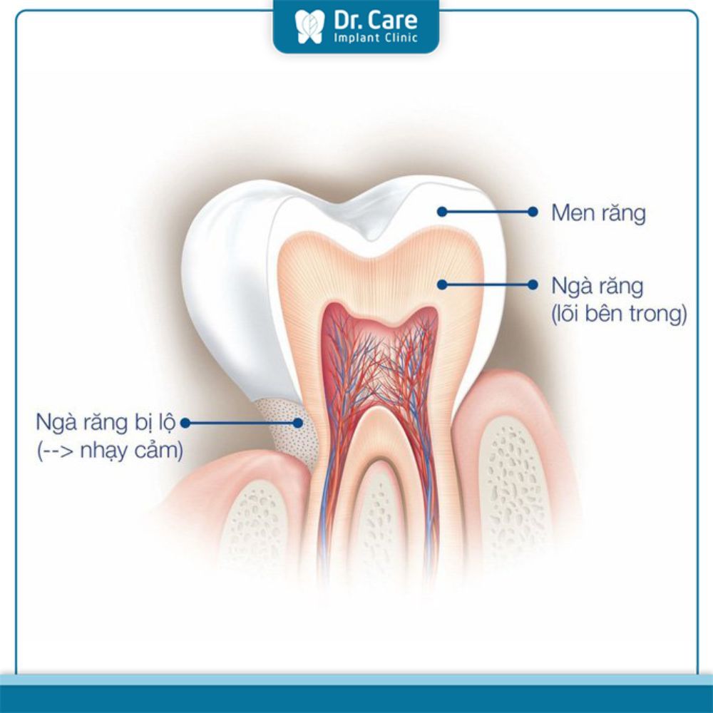 Cấu trúc, thành phần ngà răng ở răng chết tủy