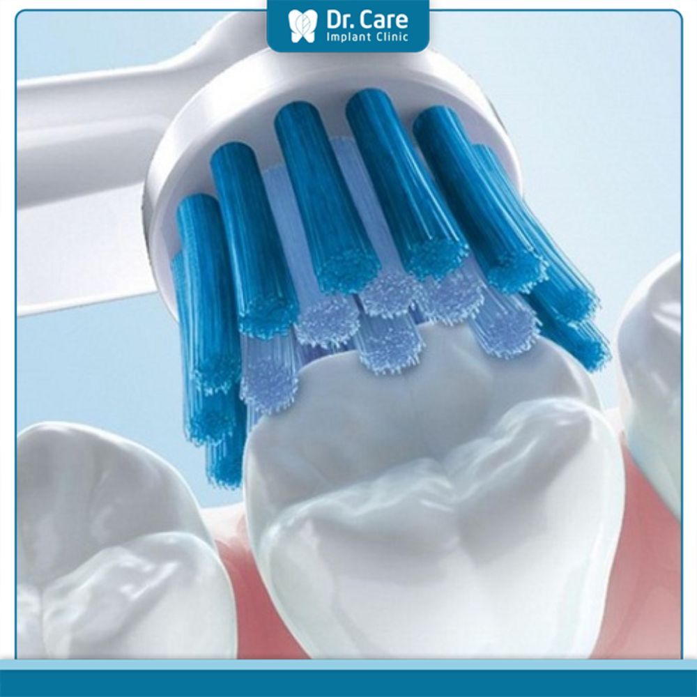 Hướng dẫn cách chăm sóc răng miệng sau khi trám răng để không bị tình trạng miếng trám bị đen
