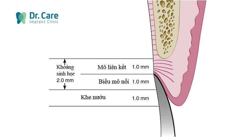 Biểu mô nướu