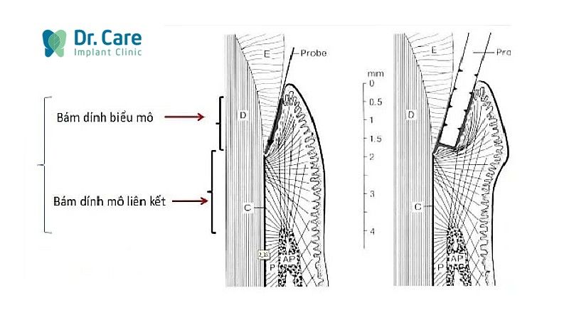 Cơ chế tự bảo vệ của mô nướu