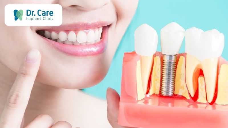 Cấy ghép răng Implant có đau không?