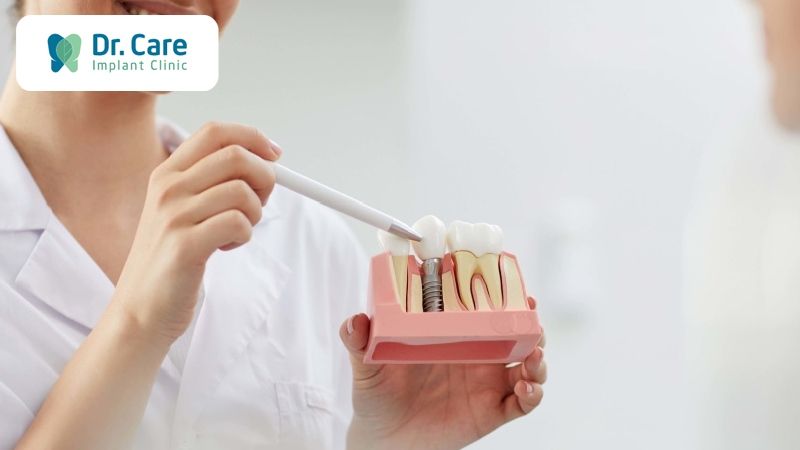 Vì sao cần khám tổng quát trước khi điều trị cấy ghép Implant?