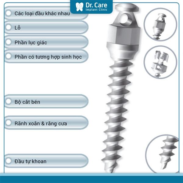 Cắm vít niềng răng là gì?