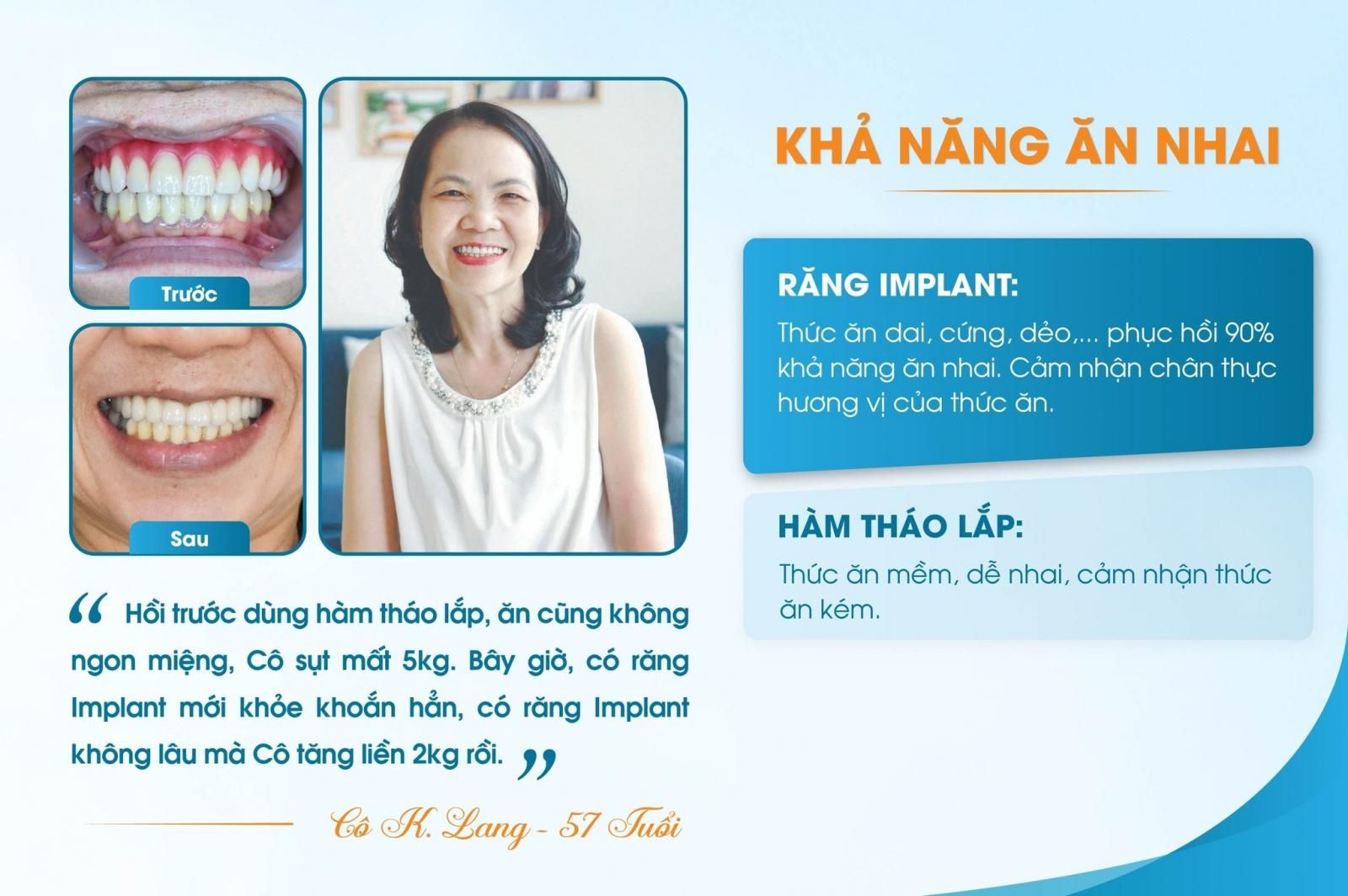 trồng răng Implant và hàm tháo lắp