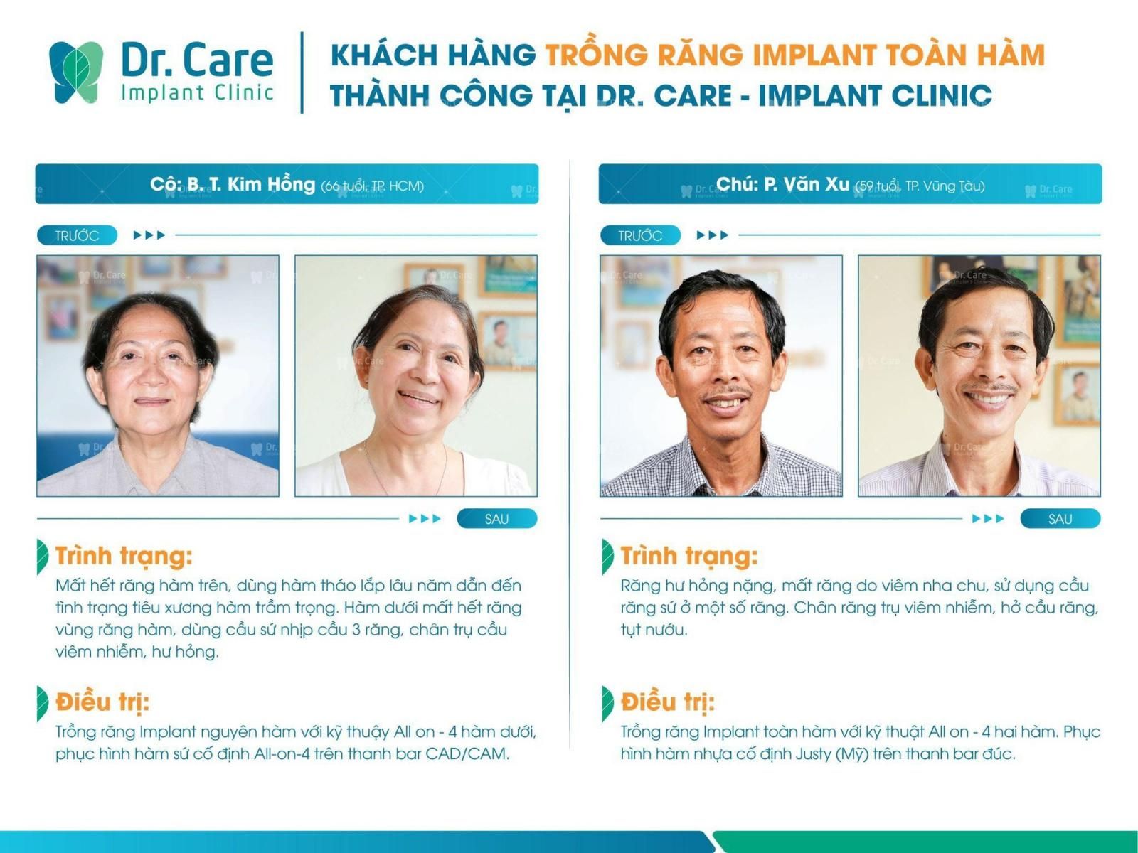 Khách hàng trồng răng Implant