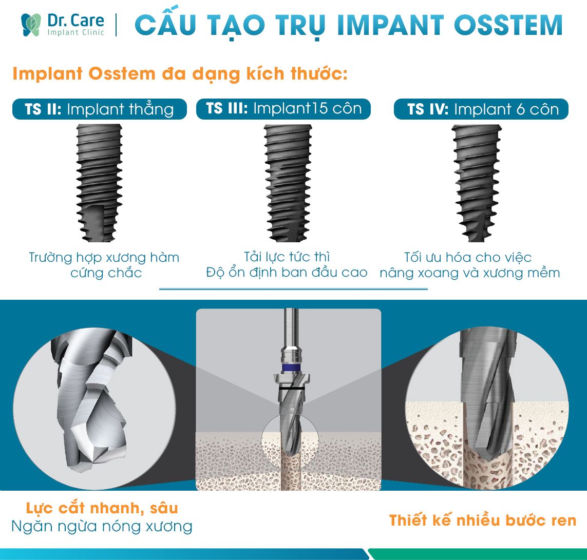 Trụ implant hàn quốc