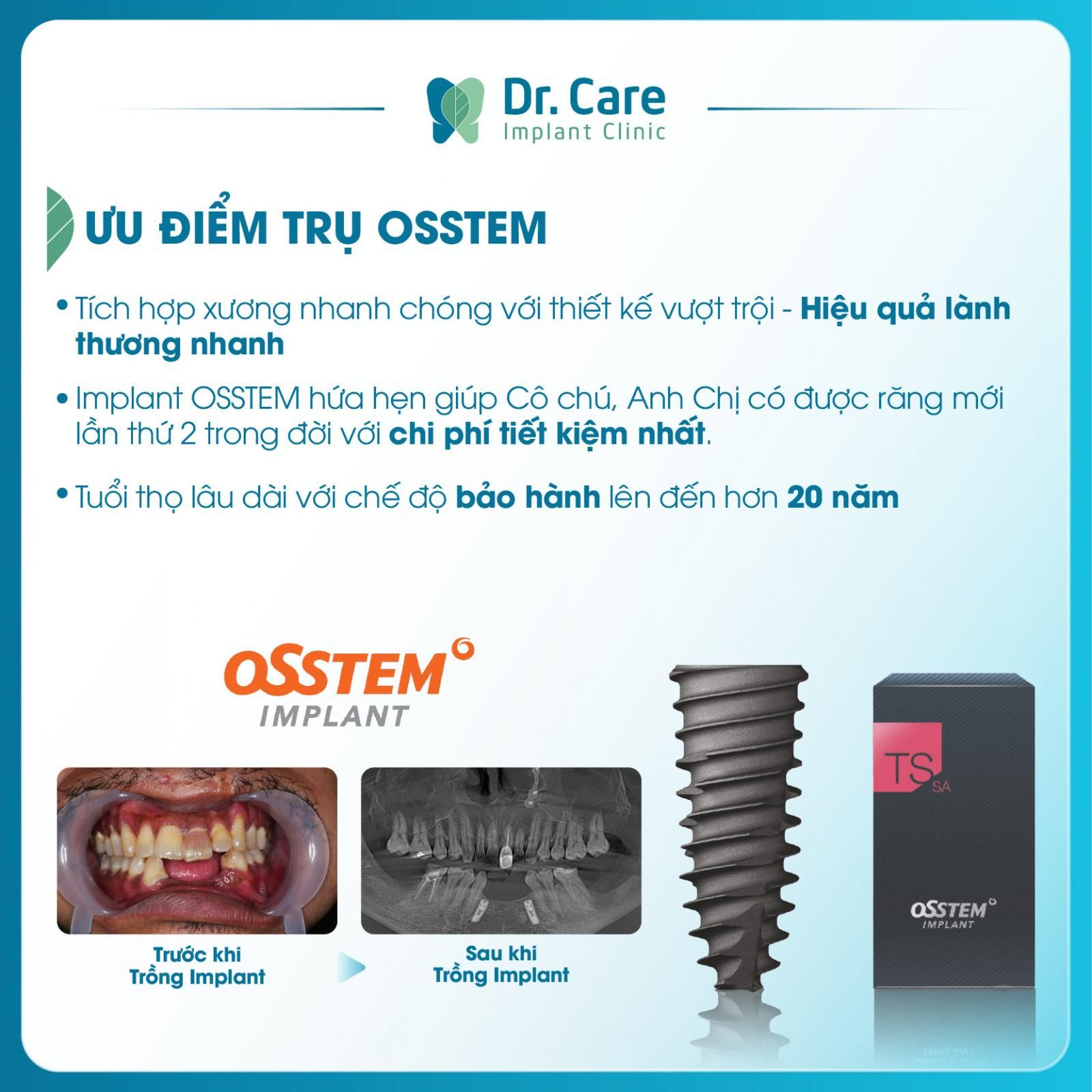 trụ implant hàn quốc osstem