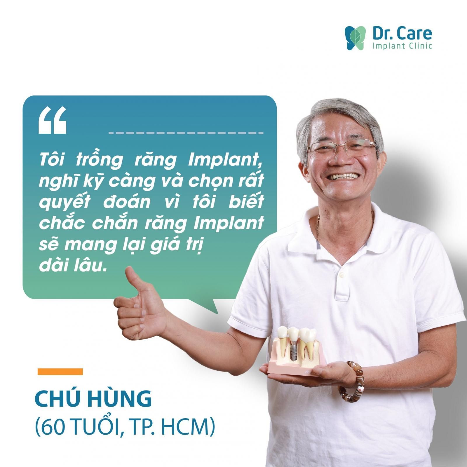 gia-cua-mot-chiec-rang-implant