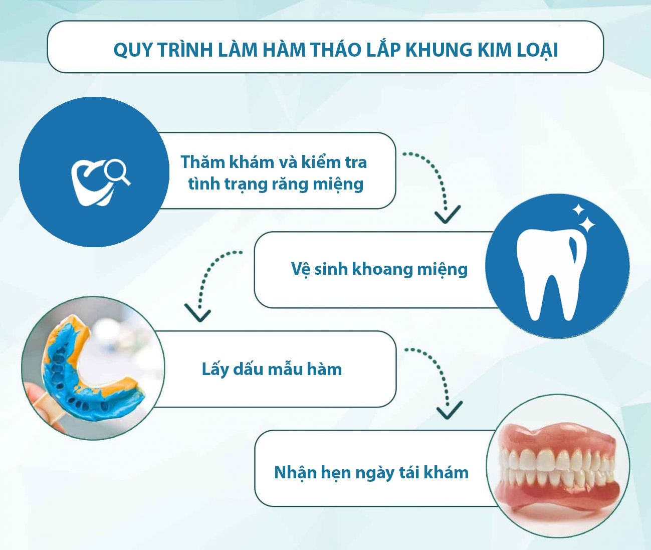 quy trình phục hình bằng hàm tháo lắp kim loại