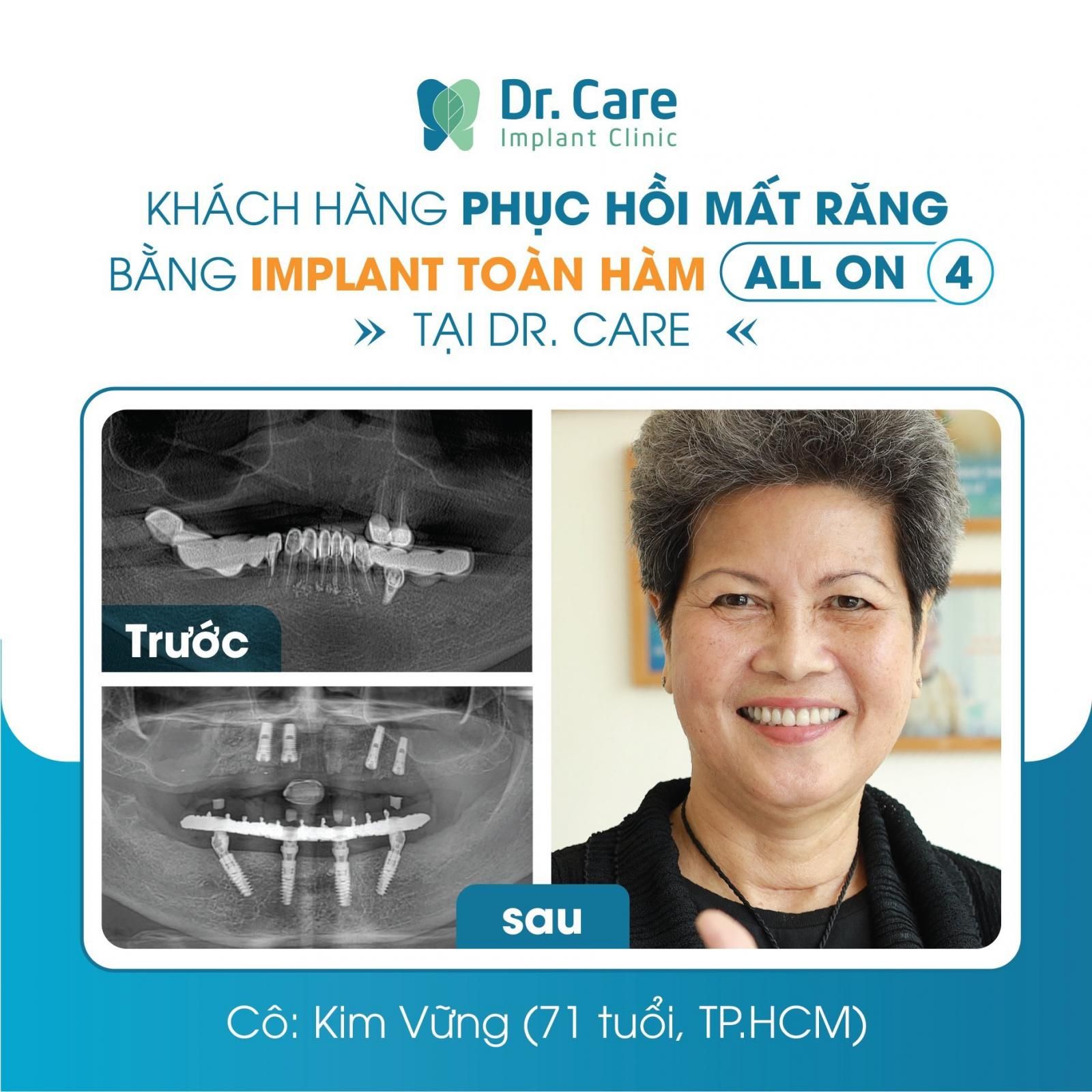 Người lớn tuổi có cấy ghép Implant được không?