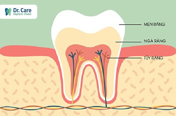 1. Sức mẻ răng là gì? Nguyên nhân gây mẻ răng