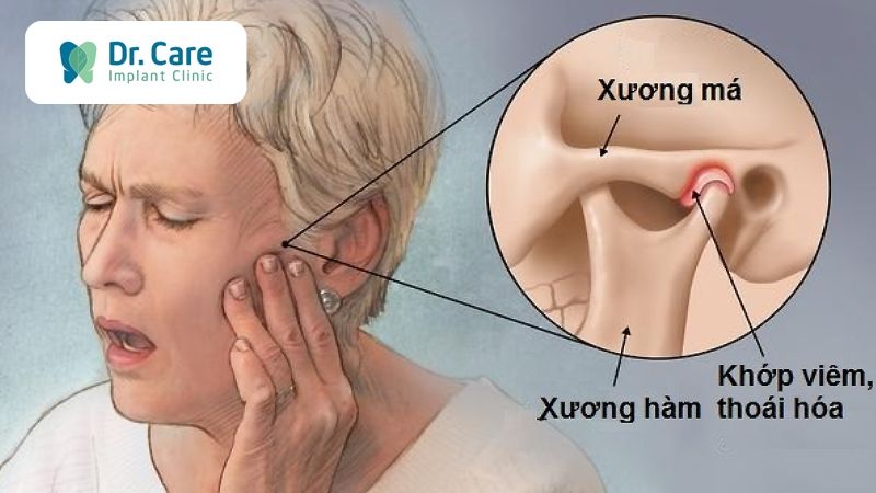 Mắc các bệnh về khớp do tuổi già