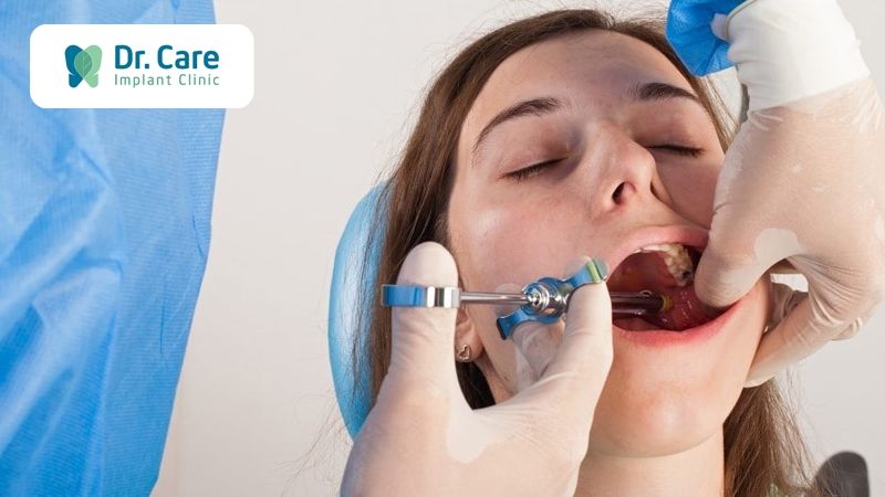 Mất răng số 5 trồng Implant có đau không?