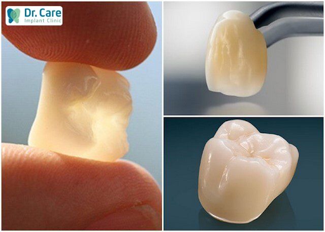 chi phí răng sứ Zirconia và răng sứ Lava