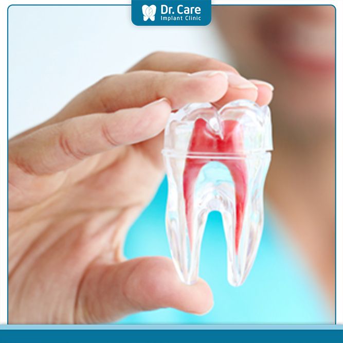Tuổi thọ của răng chữa tủy là bao lâu?