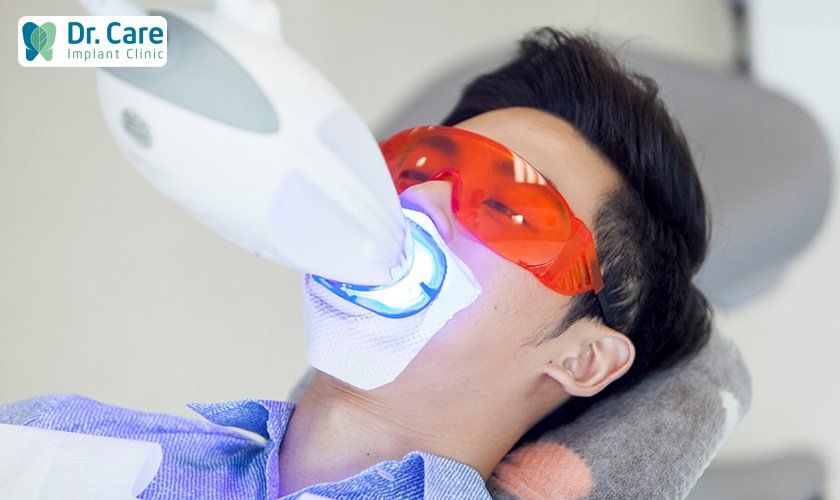 Phương pháp tẩy trắng răng bằng laser