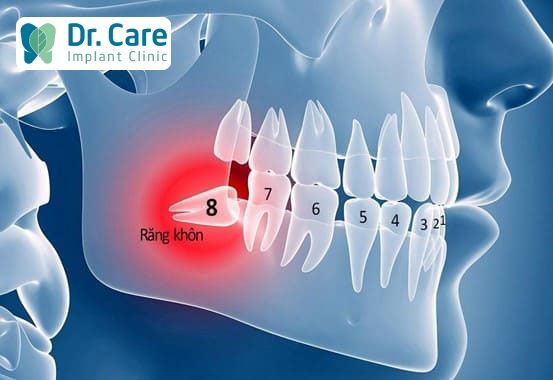 Răng số 8 là răng nào