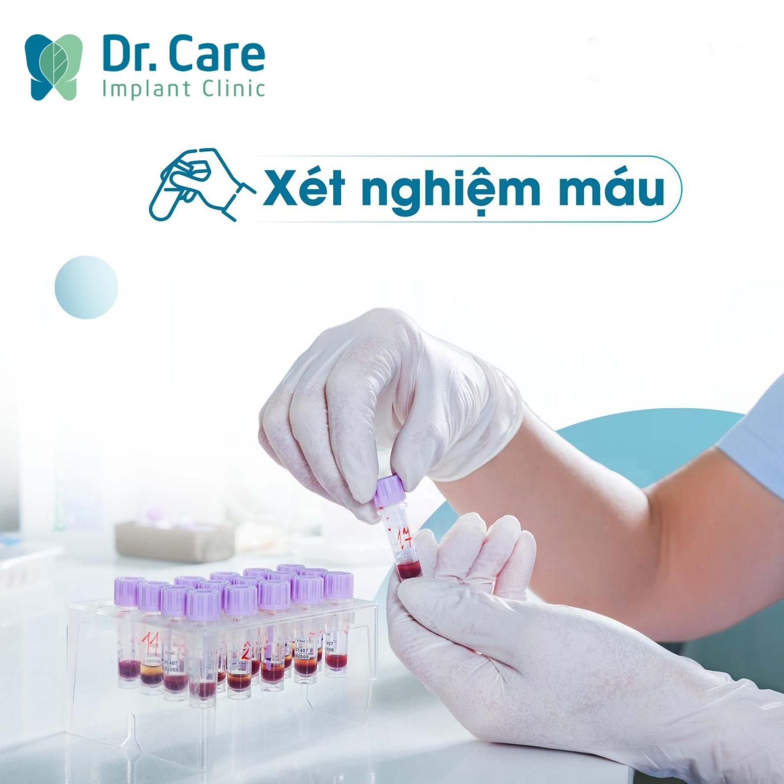 Xét nghiệm máu có cần thiết không 