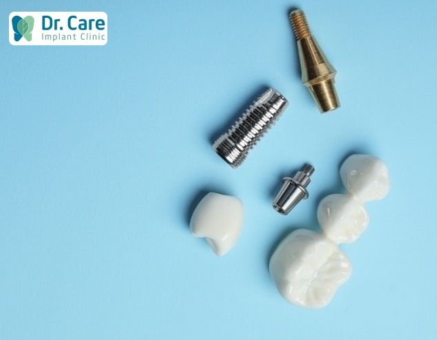 Trụ Implant Thụy Sỹ phù hợp để cấy ghép Implant