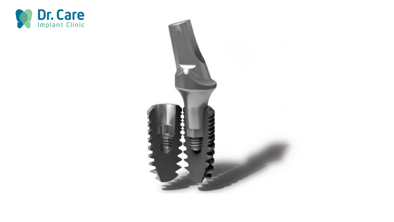 Xuất xứ của trụ Implant Global D In – Kone