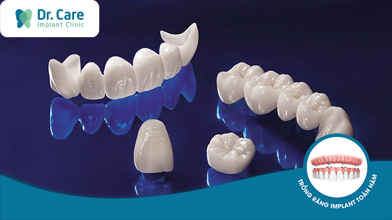 Răng sứ Ceramill là gì?