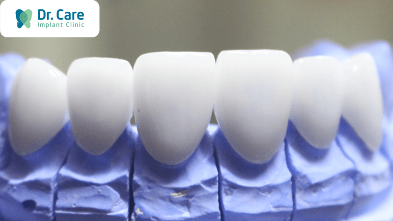 Ưu điểm của răng sứ Ceramill