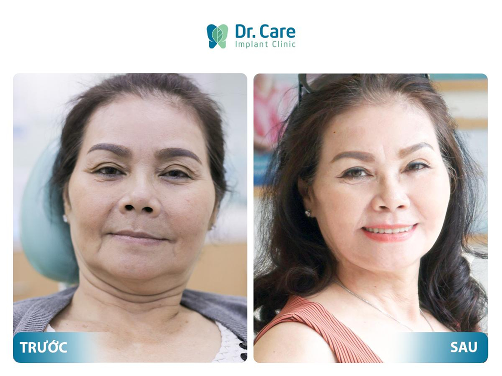 Thông tin liên hệ nha khoa Dr. Care