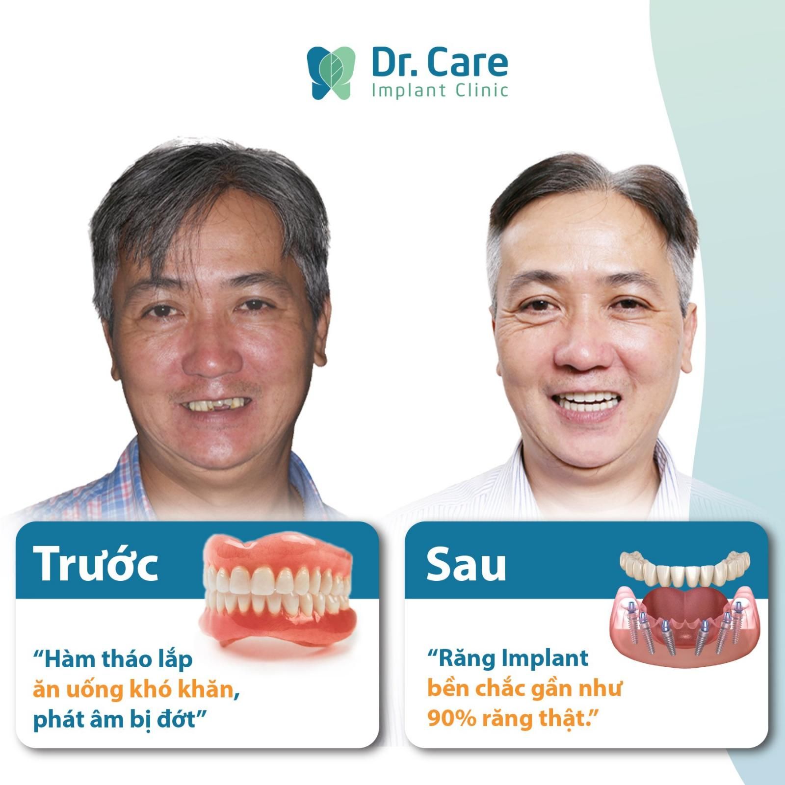 trồng răng implant cho người già