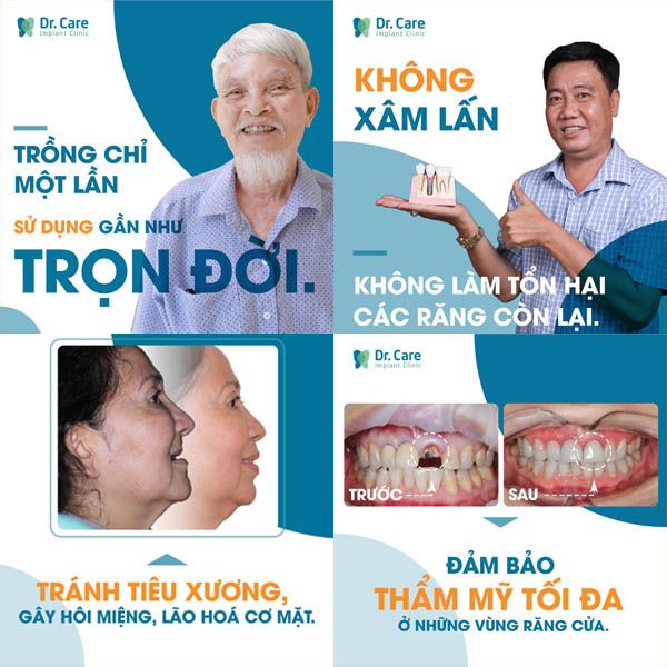 Trồng răng Implant cho người già