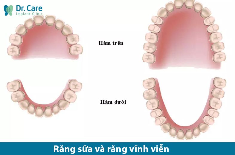 Răng vĩnh viễn là gì?