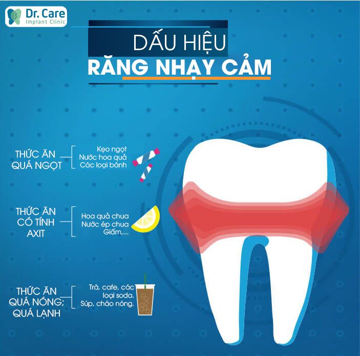 Răng nhạy cảm 