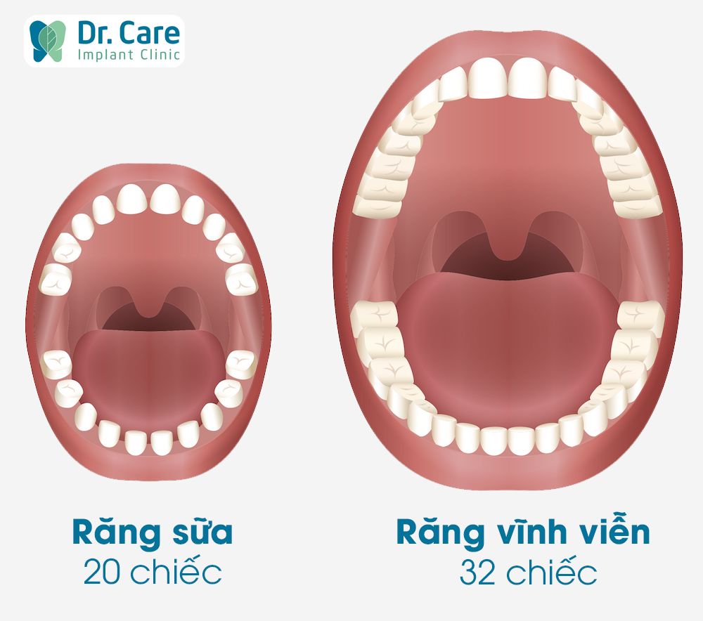 Răng vĩnh viễn là gì? 