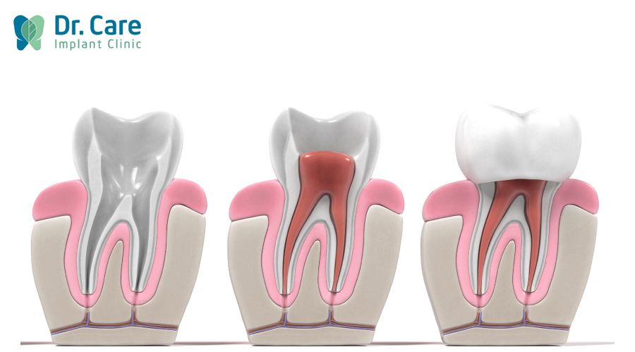 Giúp ngăn ngừa biến chứng về sau