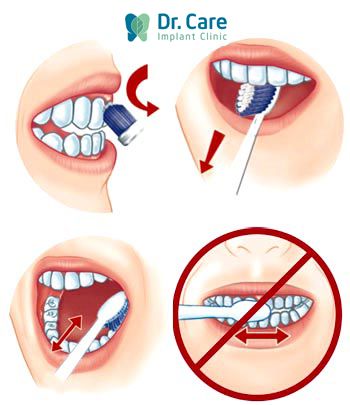 Những lưu ý để đánh răng đúng cách