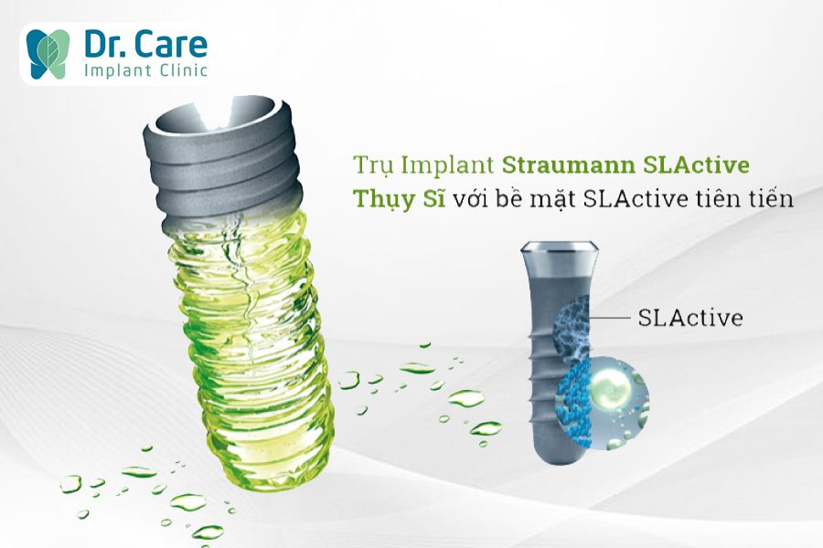 Trụ Implant Thụy Sĩ là gì