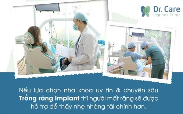 5 lý do tại sao giá trồng răng Implant lại cao hơn các phương pháp thông thường?