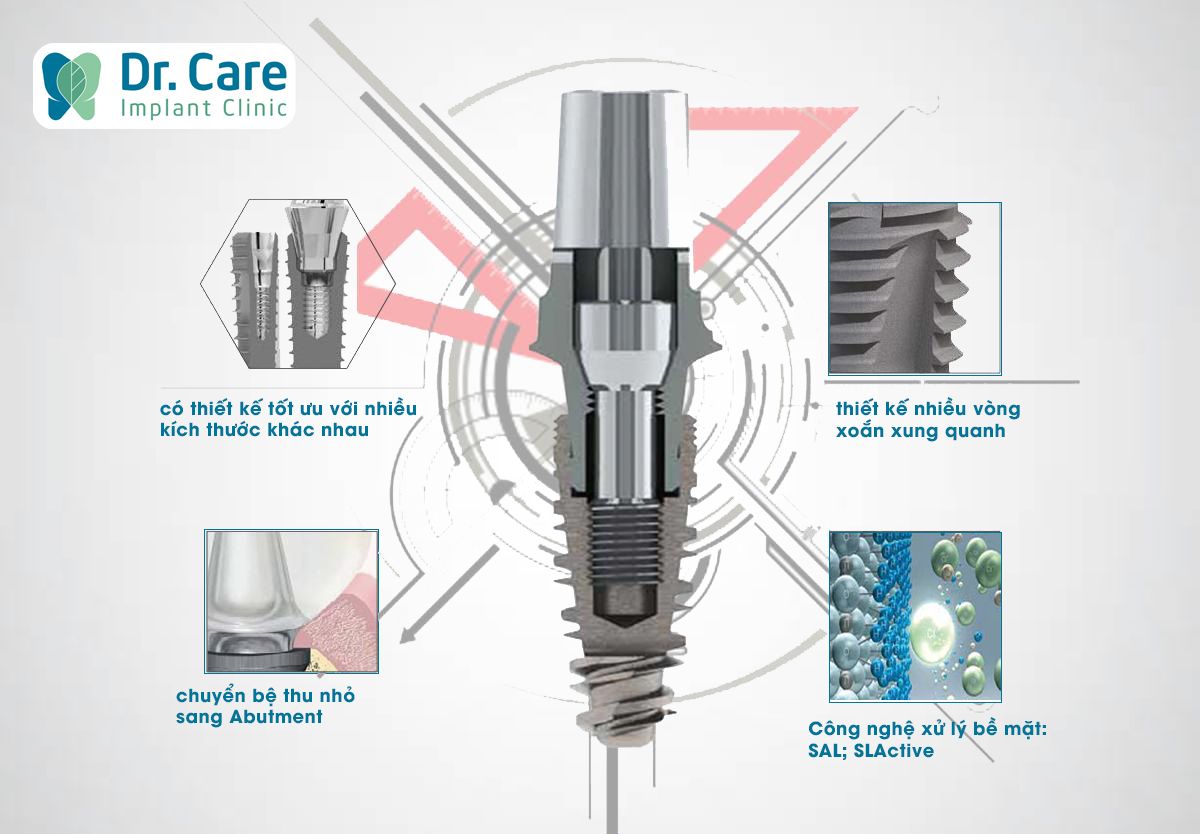 Ưu điểm trụ Implant Thụy Sỹ