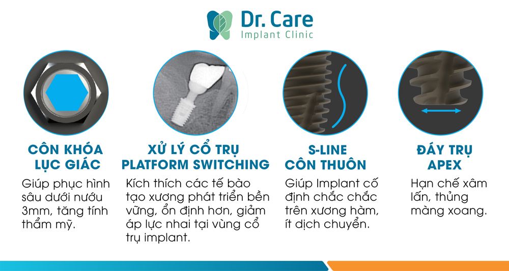 Ưu điểm trụ Implant Hàn Quốc