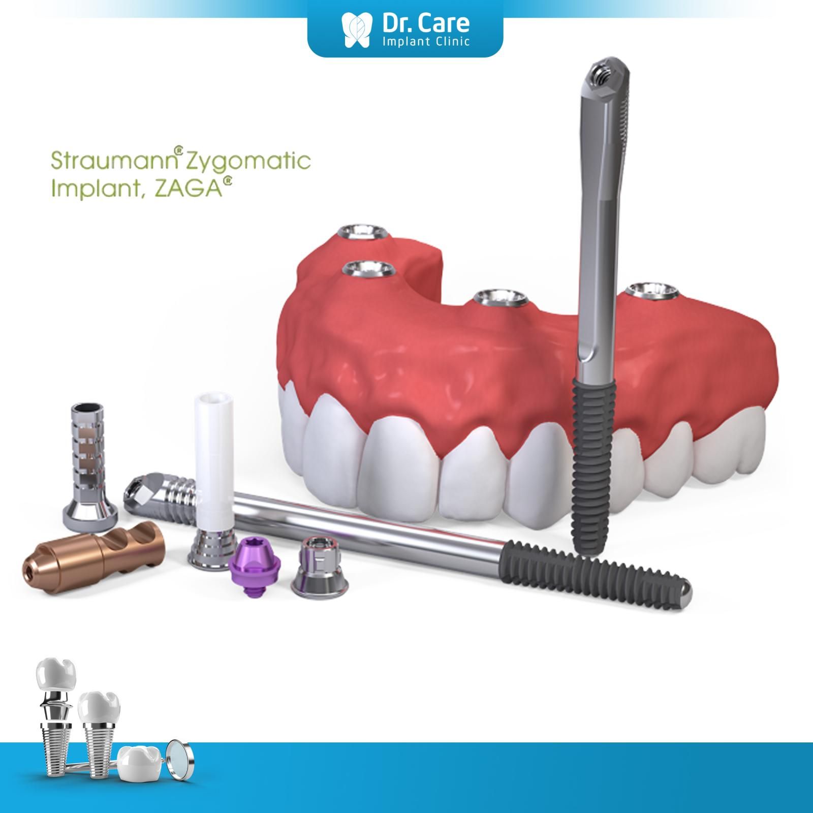 Cấu tạo của trụ Implant Thụy Sĩ Straumann