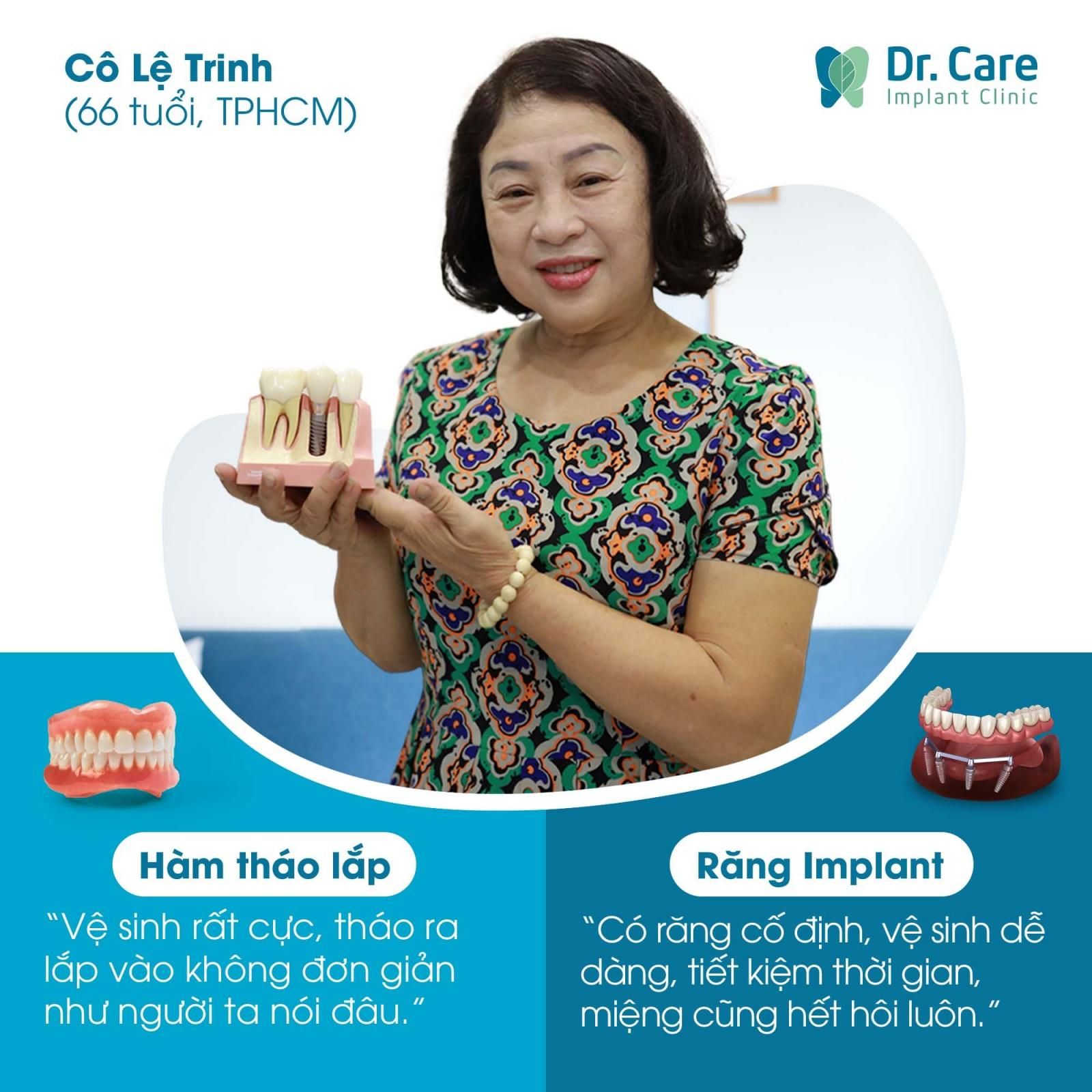 Tiêu chí chọn phương pháp trồng răng phù hợp