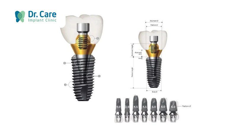 Các loại trụ Implant phổ biến hiện nay 