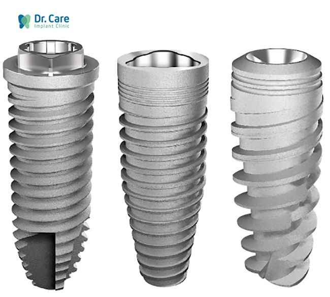 so sánh các loại trụ implant