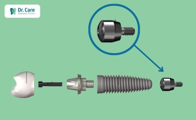 Healing Abutments khi hỏng có thể thay thế được không?