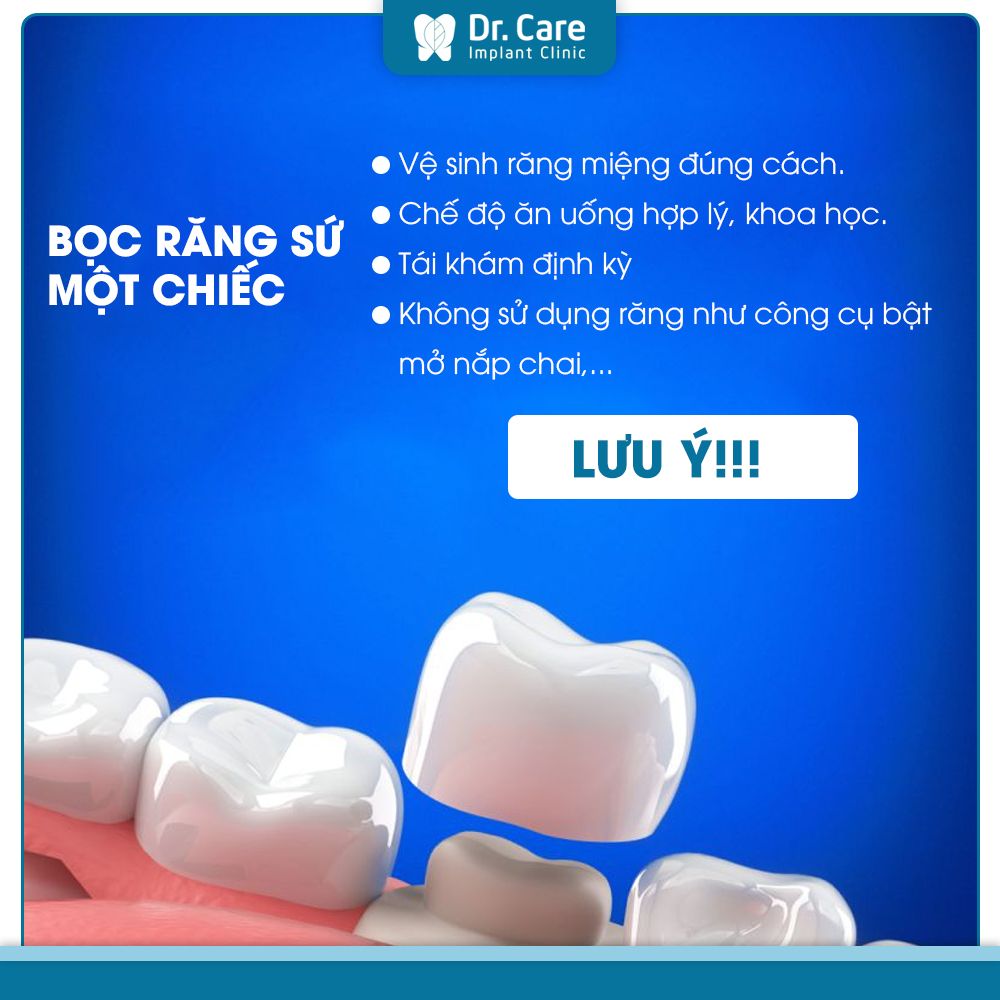 Những lưu ý sau khi bọc răng sứ 1 chiếc?